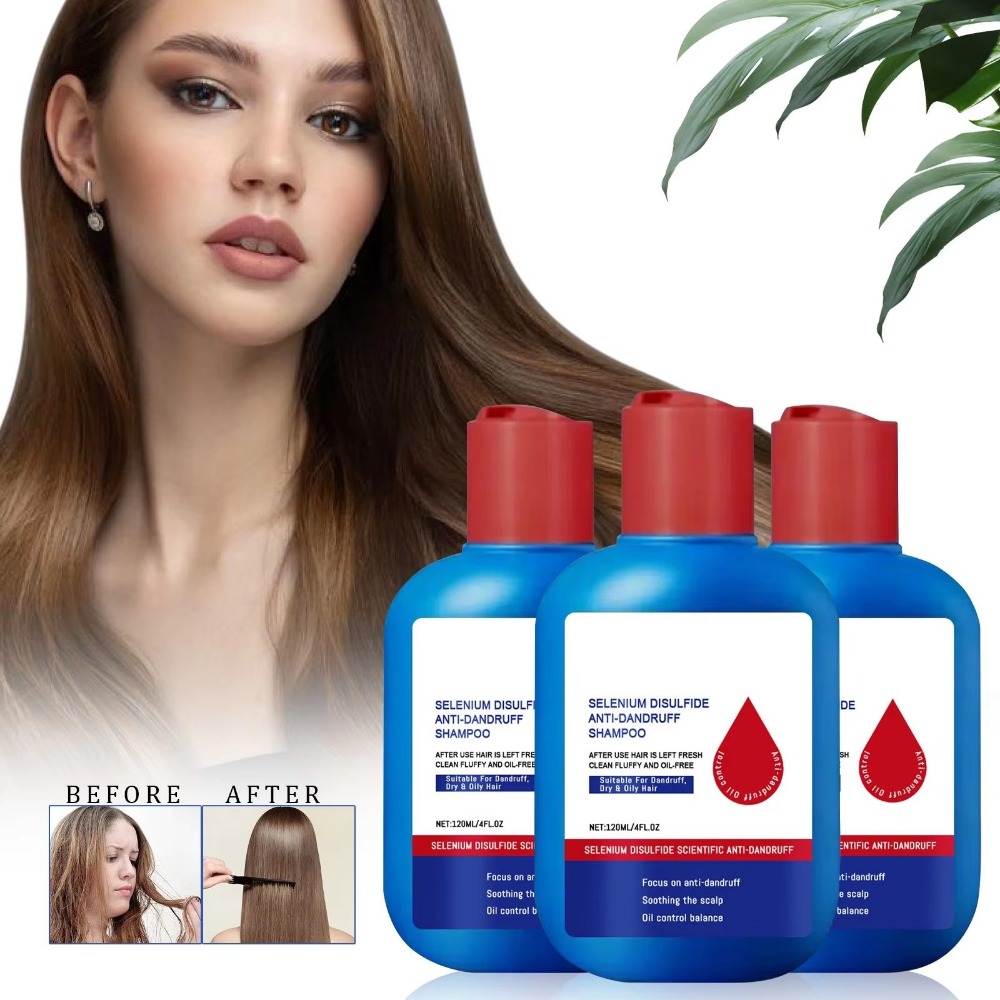 Hair Care Dandruff - Nowy szampon Nipori 120ml Kontrola sebum