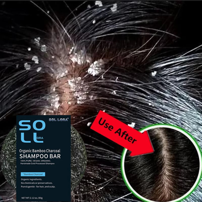 Hair Care Dandruff - Szybkie mydło do włosów przeciwłupieżowe, naprawcze