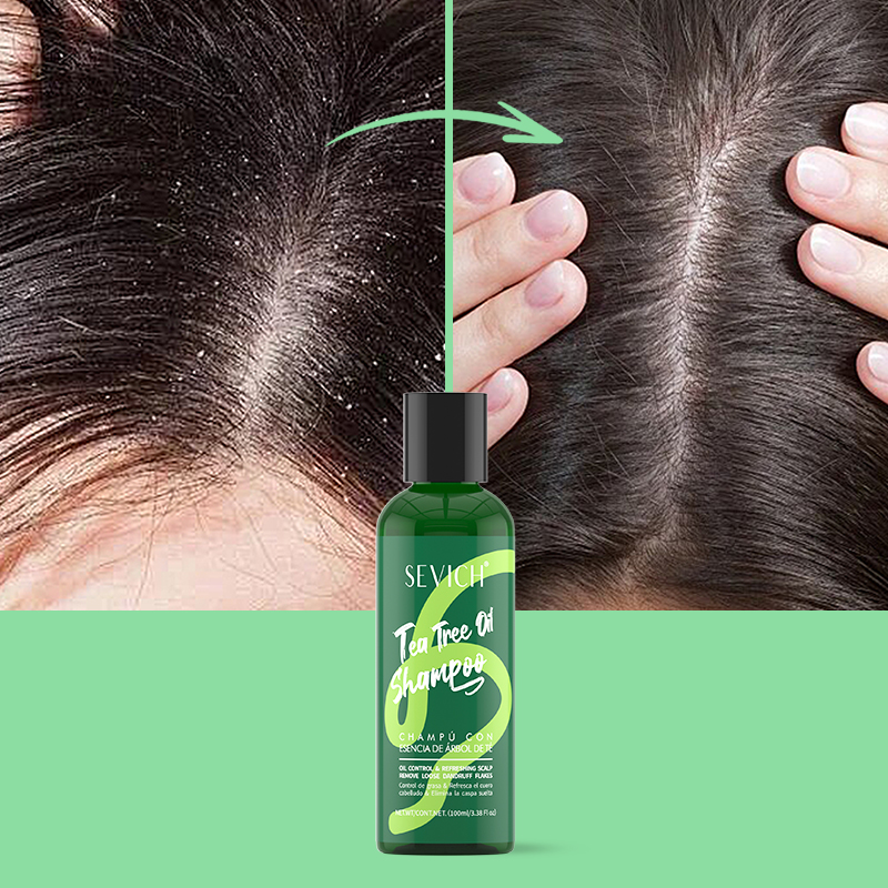 Zestaw Szamponu i Odżywki z Es – Hair Care Essence recenzja i cena