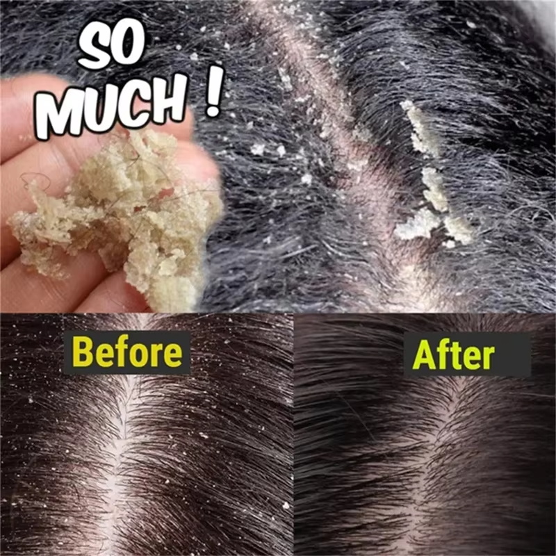 Szybkie mydło do włosów przeci – Hair Care Dandruff recenzja i cena