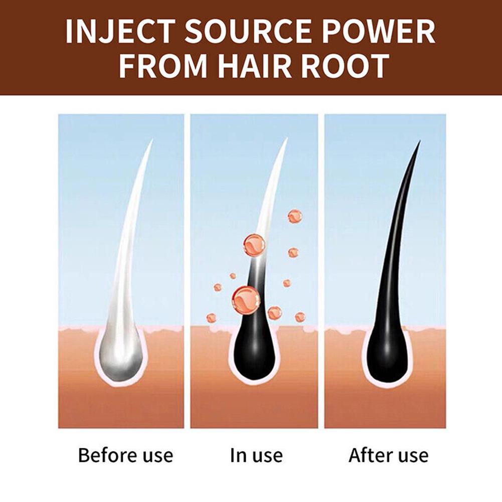 Naturalne mydło ręcznie robion – Hair Care Dandruff recenzja i cena